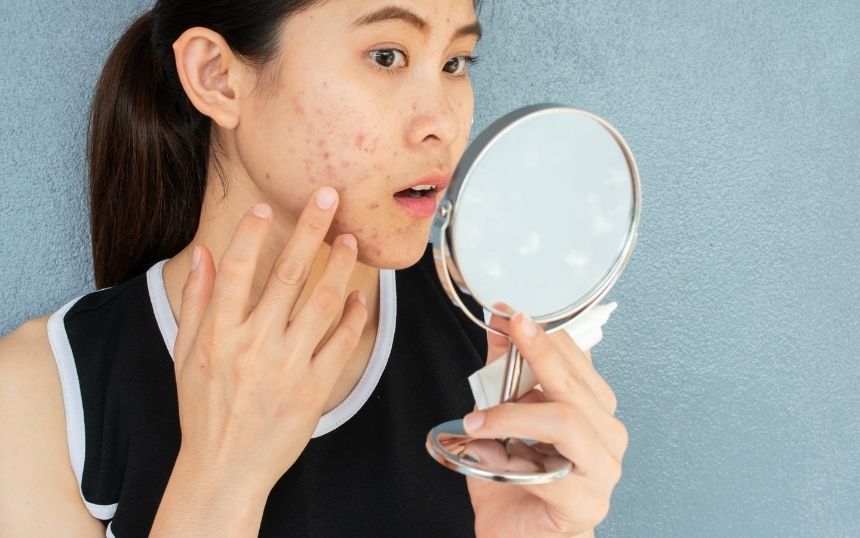 Changing Your Lifestyle: 4 Bad Habits That Damage Your Skin