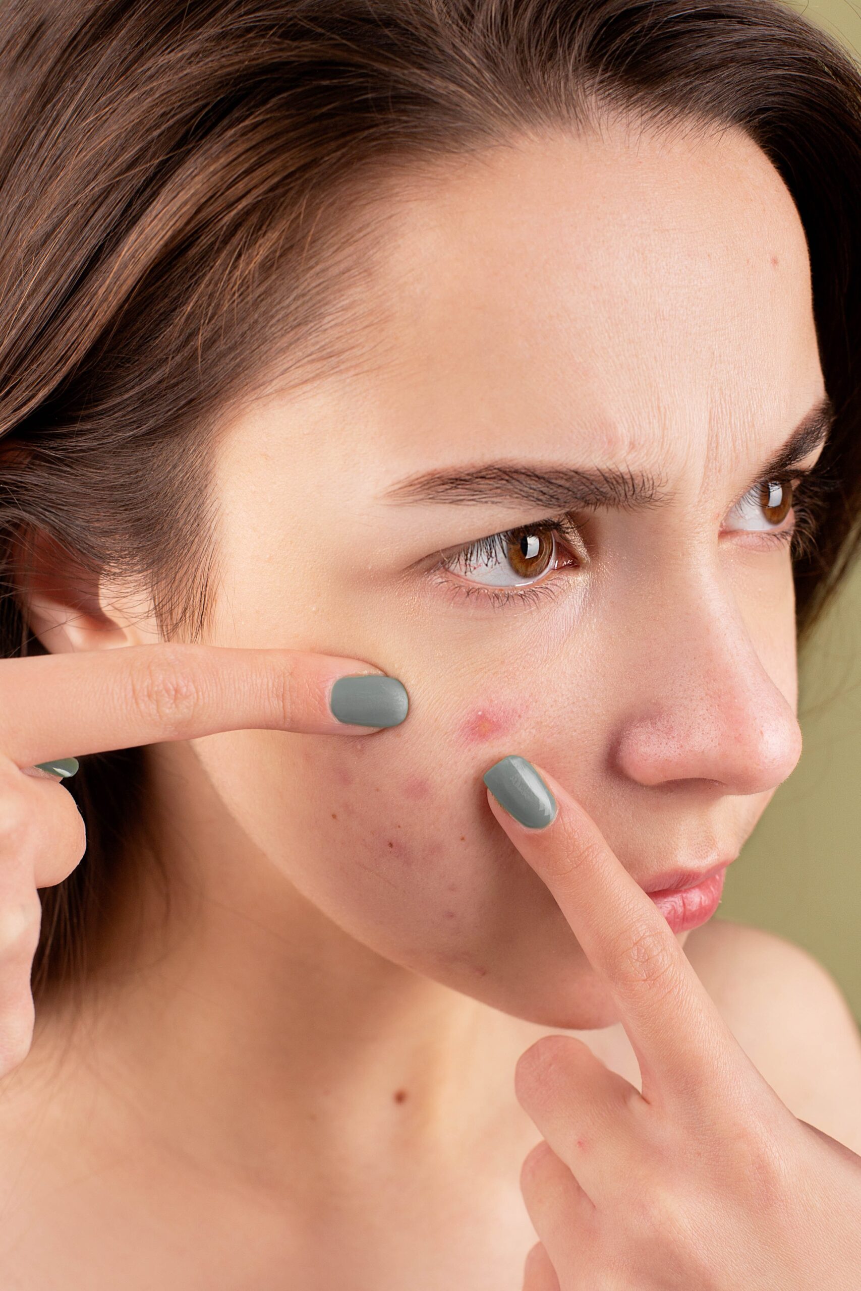 Laser Treatment For Acne: How Does It Work, Expectations And More