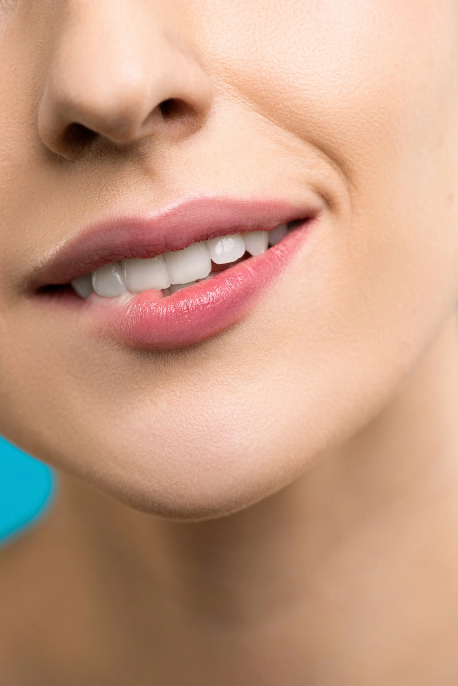 Get a Brighter Smile with GlossRay Whitening Teeth